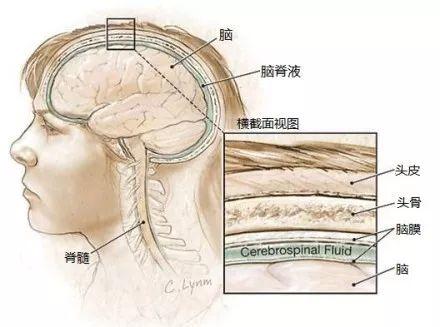 女子没感冒却持续流鼻涕，竟意外发现脑脊液泄漏