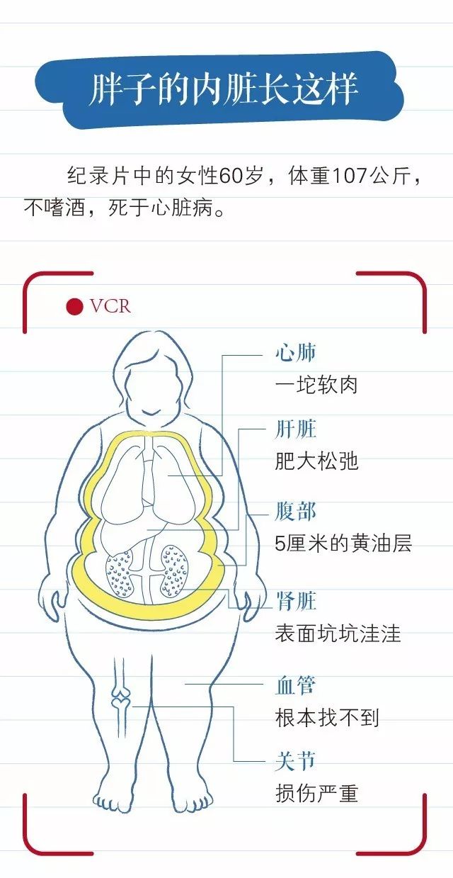 胖一点都不能任性！揭秘肥胖背后的真相与应对之道——全面剖析身体每一个部位的重要性及游戏开发视角的启示。