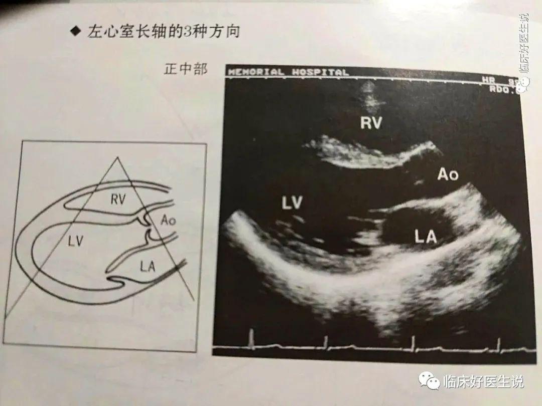 女子因丈夫去世患心碎综合征